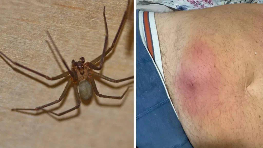 brown recluse spider