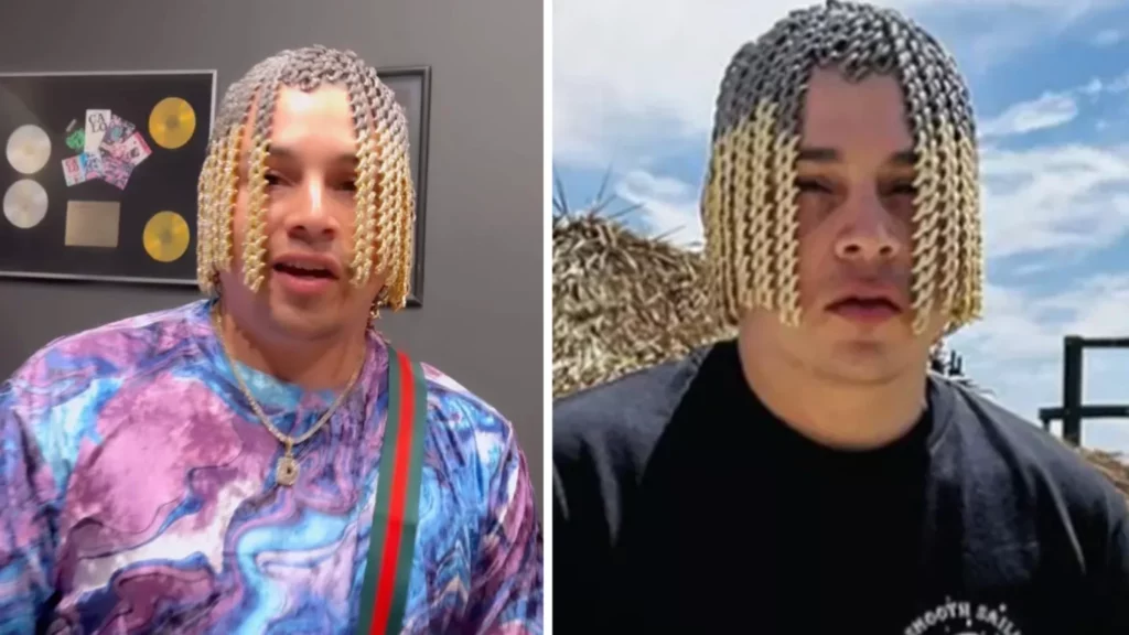 rapper who had gold chains Implanted into his Head