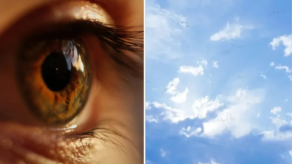 Eye Doctor Explains What to Do If You Start Seeing Floaters