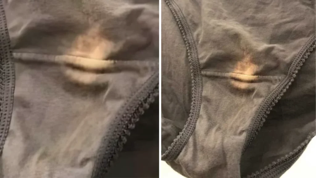 Here's What a 'Bleach' Spot on Your Underwear Could Mean