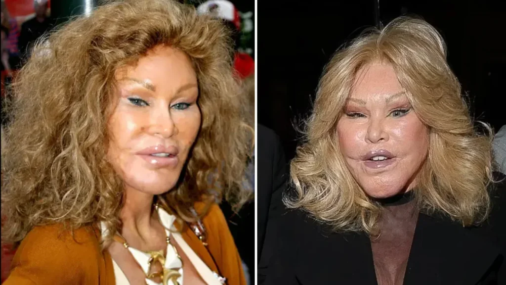 Jocelyn Wildenstein Shuts Down Plastic Surgery Rumors