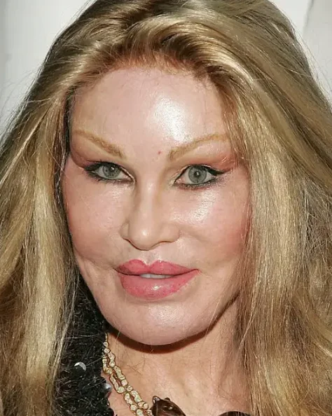 Jocelyn Wildenstein remained a figure of fascination