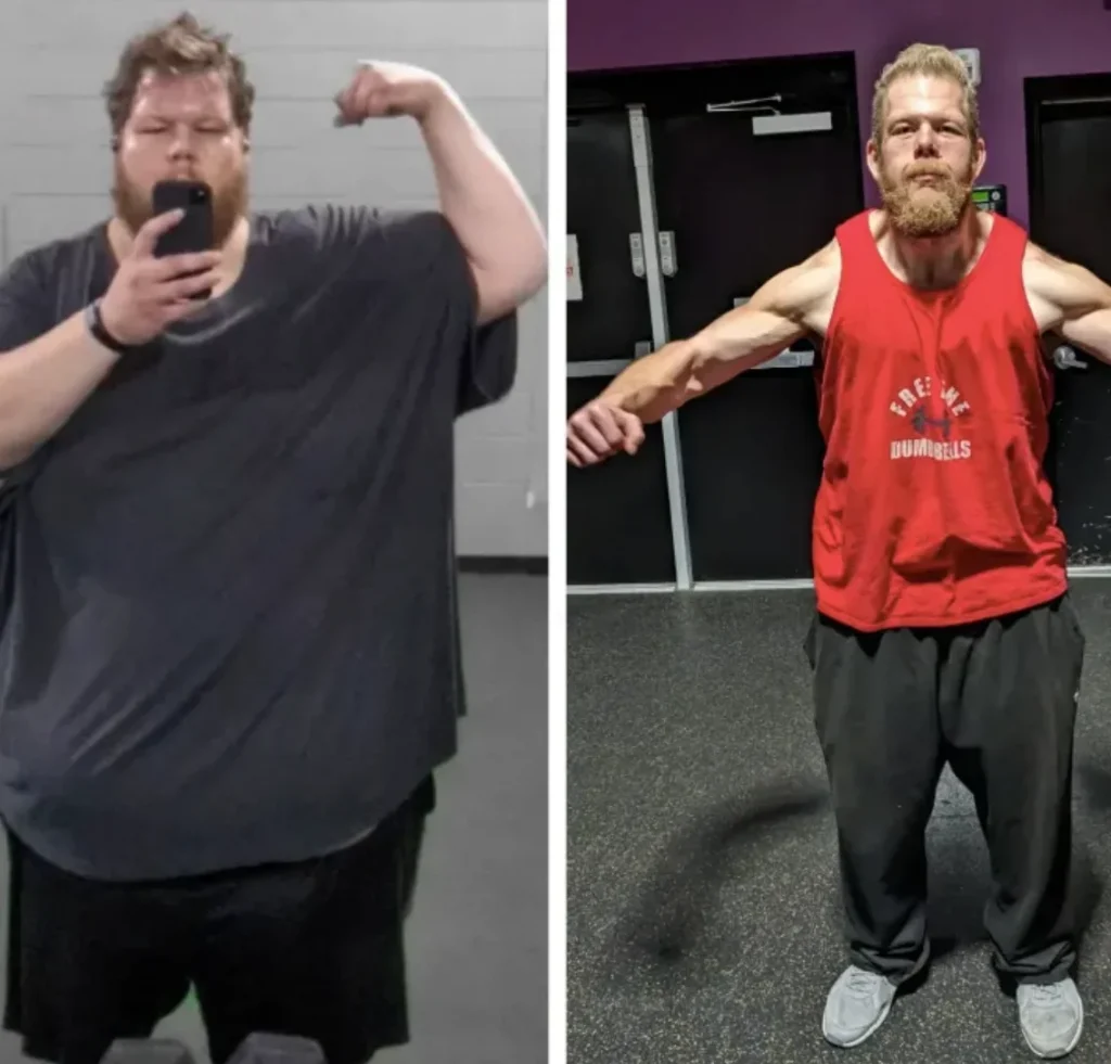 Man Jaw Dropping 336lb Weight Loss