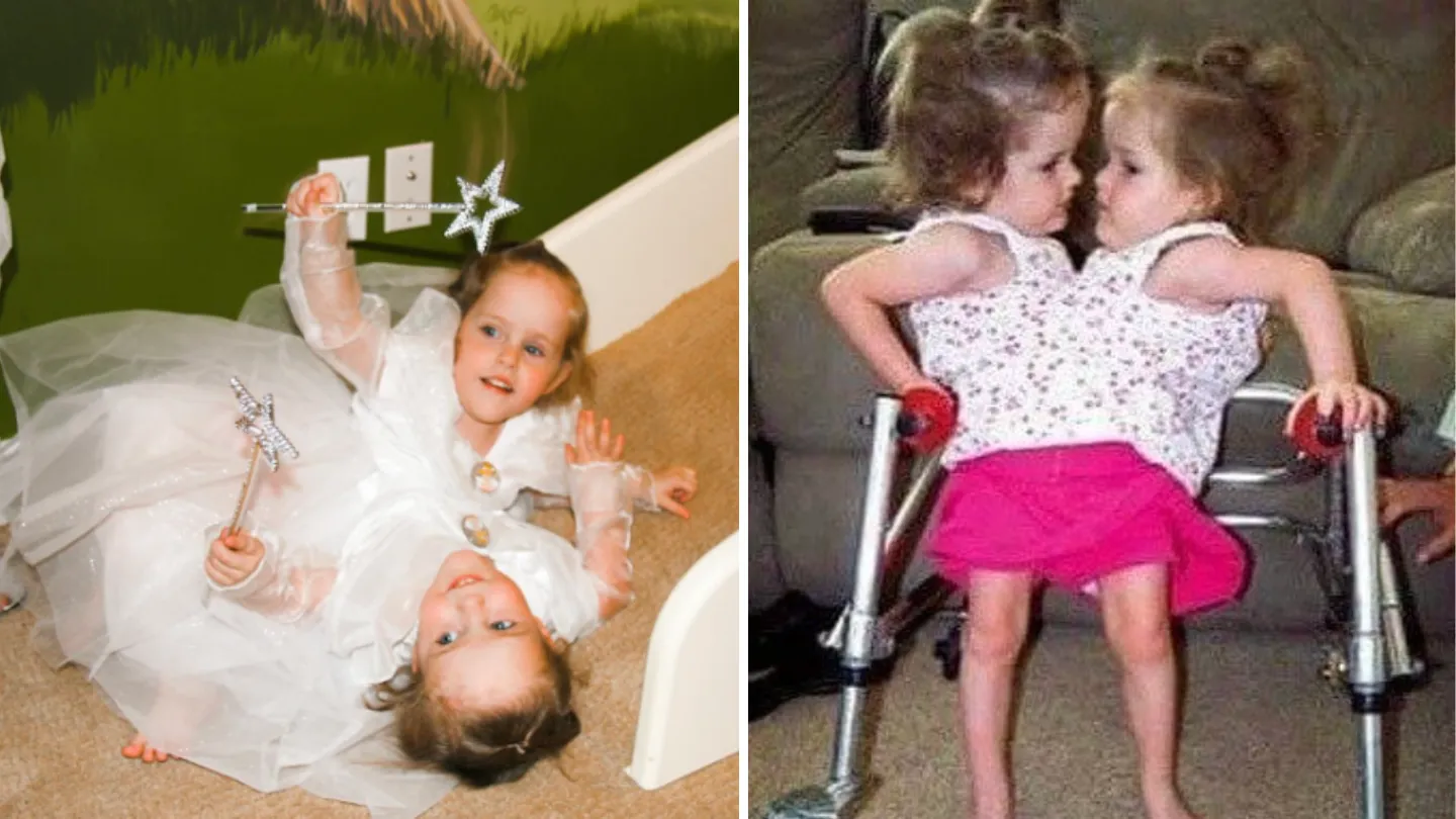 Here's What Conjoined Twins Kendra and Maliyah Are up to These Days