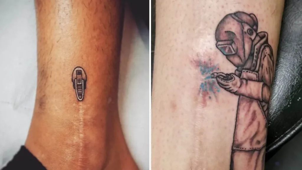 People Who Turned Scars and Birthmarks Into Works of Art