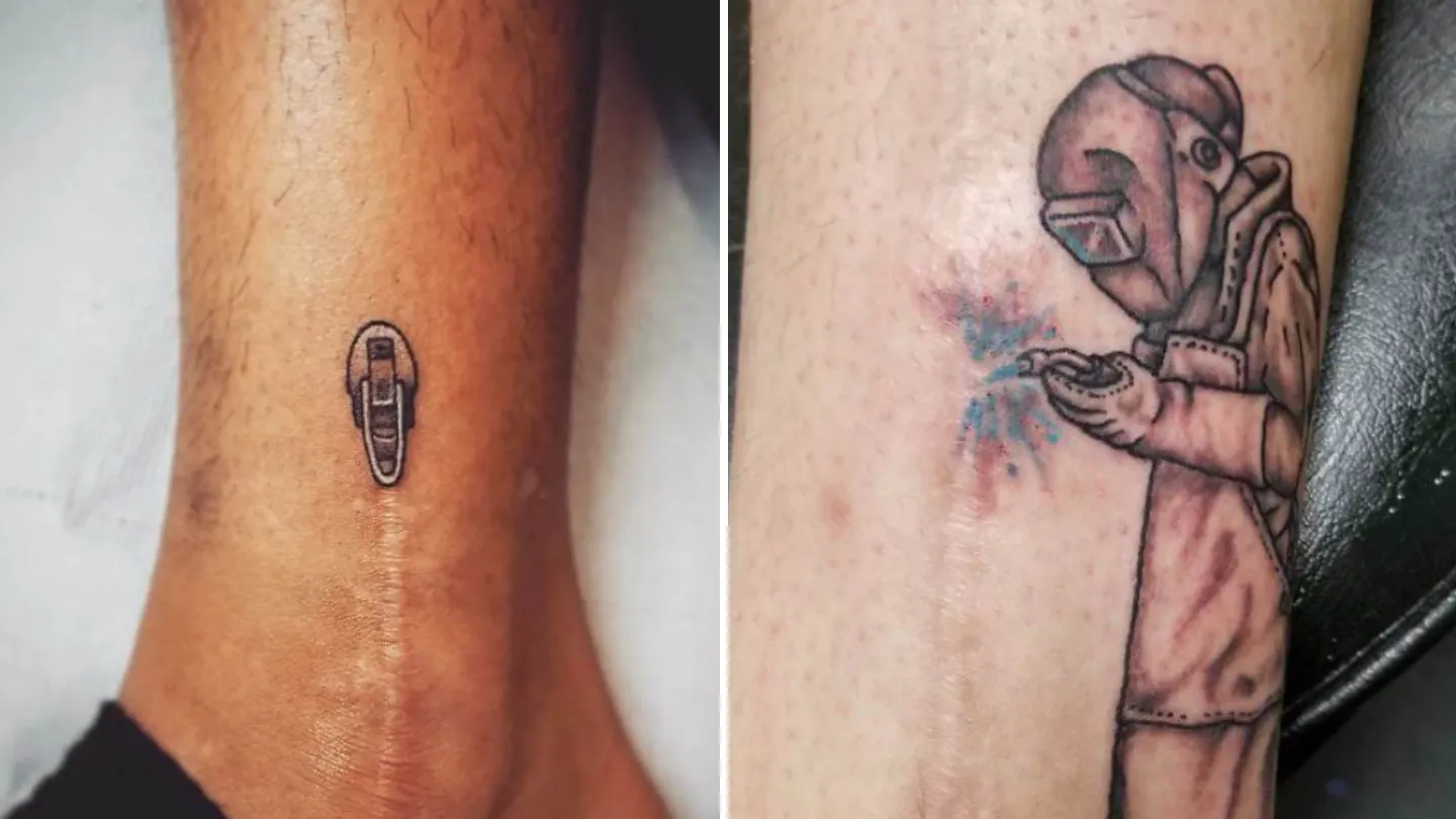 People Who Turned Scars and Birthmarks Into Works of Art